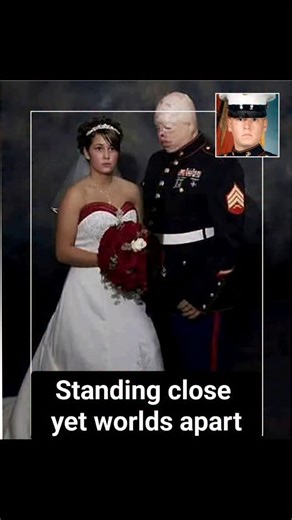 Macabre Knowledge on Instagram: "A bride in white. A groom in dress uniform. Both standing close — yet worlds apart. This is Tyler Ziegel, a United States Marine, and Rene Kline, on their wedding day in 2006. At the time, Tyler was just 24 years old. Only months earlier, while serving in Iraq, Tyler survived a devastating explosion during combat operations. He lived — but with injuries that permanently altered his body and his future. He lost his left hand, several fingers on his right, part of