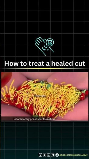 How Your Skin Heals After a Cut | The 4 Stages of Wound Healing Explained 🩹