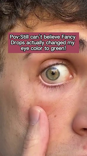 Are Color Changing Eye Drops Really Worth It? Find Out Now!
