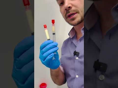 Bio-filler. How to convert PRP into most natural filler for rejuvenating and re-volumize the face.