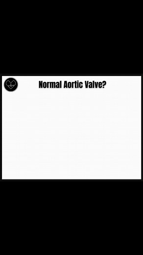 12K views · 85 reactions | You’re scanning the parasternal long-axis view and notice this finding  What is it? What’s this called? A) RAC sign B) Diastolic doming C) Systolic doming D) Hockey stick leaflet  Want 1,200+ practice questions, detailed explanations, and study tools to help you pass your Adult Echo Board Exam?  Visit theechojourna.net to start your prep today  | The Echo Journal | Facebook