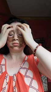 4.5K views · 118 reactions | পেঁয়াজের রস চুলের জন্য খুবই ভালো 珞 | Dolon Mukherjee | Facebook