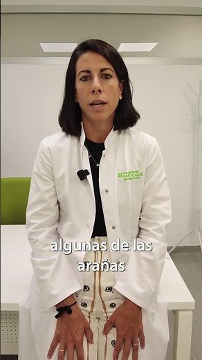¿Se convierten en varices las arañas vasculares?