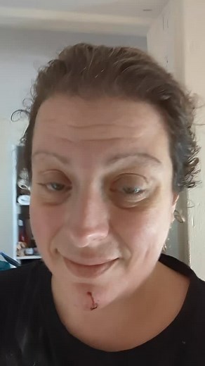 Injury update and best friend day for Furby #furbythebirb #parrot #cockatoo #bite #injury | Furbythebirb