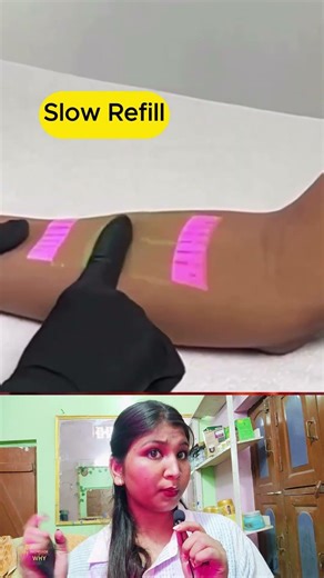 This Device Lets You See Your Veins 😳💉 | Future Medical Tech Revealed! #doctor #dr #professorofwhy