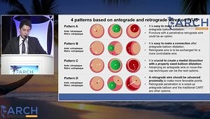 IVUS Image Guided CTO PCI