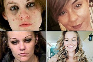 Former drug addicts share incredible before and after photos