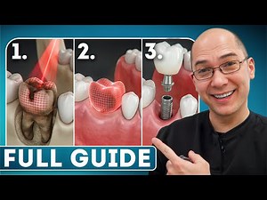 Dental Implant Procedure Full Guide - Step by Step