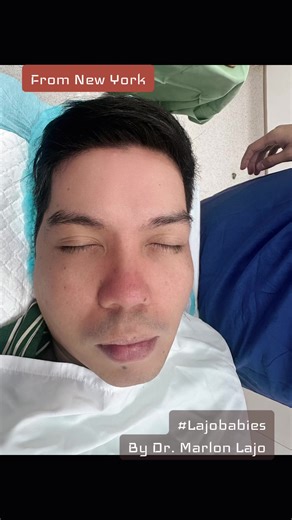 Day 1 Recovery of Rhinoplasty with Ear Cartilage