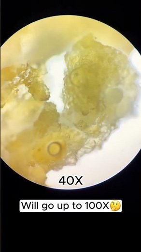 fried chicken under a microscope 🔬