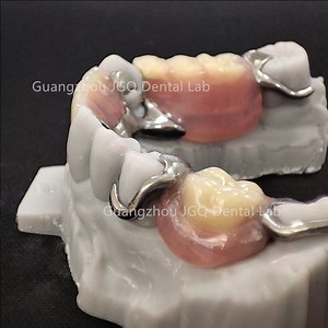 [Hot Item] 3D Printing Partial Framework Durable Rpd Prosthesis Dentures Hot Delivery Service
