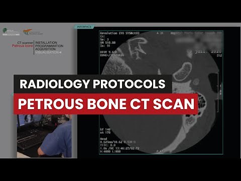 Petrous bone CT Protocol: A Radiology Techs Video Guide
