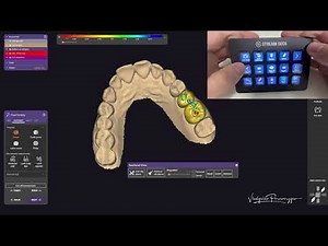 Custom Stream Deck MK2 Tool Profile for Exocad