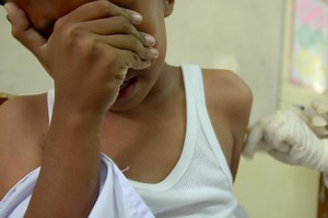 Difteria: ¿qué es, cómo se contagia y quiénes corren peligro al tenerla?