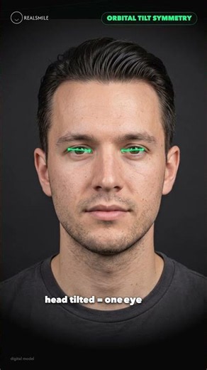 Orbital Tilt Symmetry — Usually the Head, Not the Face (60-Second Explainer)