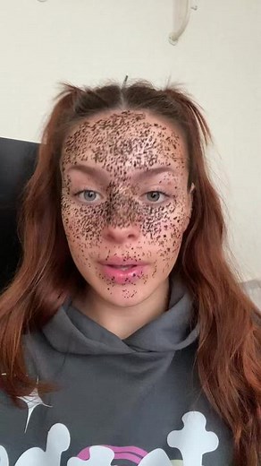 Another henna freckle transition as you love them so much #henna #hennafreckles #fakefreckles #fauxfreckles