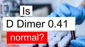 Treatment and symptoms of D Dimer 0.41 ug/mL | Diet for normal D Dimer level 0.41 ug/mL