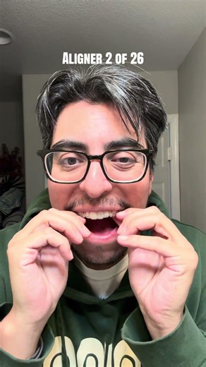 Invisalign Journey - Aligner 2 of 26 #invisalign