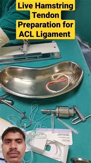 live hamstring Tendan preparation for ACL Ligament surgery #medicosstuff #hospitaldoctor #ot #ACL...