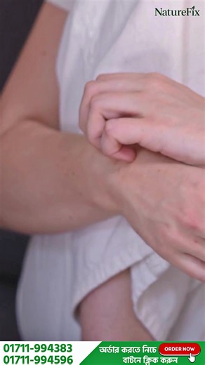 ⛔ সাত দিনে চুলকানি এলার্জি একদম নিয়ন্ত্রণে চলে আসবে আর 30 দিনের মধ্যে সকল প্রকার চুলকানি ও এলার্জির জীবাণু রক্ত থেকে ধ্বংস করে আপনাকে দিবে স্থায়ী সমাধান এবং জীবনে আর কখনো এই চুলকানি এলার্জি হবে না ইনশাআল্লাহ👇 🌿চু’ল’কা’নি এ’লা’র্জি দূর করে। 🌿রক্ত এ’লা’র্জি দূর করে। 🌿 দা’উ’দ জনিত সমস্যা । 🌿 ডাস্ট ও কোল্ড এ’লা’র্জি দূর করে। 🌿 হাঁ’চি- কা’শি জনিত সকল এ’লা’র্জি দূর করে। 🌿 সকল প্রকারের এ’লা’র্জি দূর করে। 🌿 ইলিশ চিংড়ি মাছ গরু হাঁসের গোস্ত নিশ্চিন্তে খেতে পারবেন, 🌿 আবহাওয়া ও পরিবেশ পরিবর্তন 