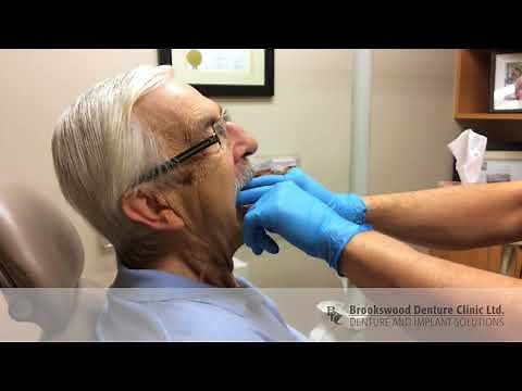 Lower Suction Dentures - No Adhesive, No Implants!