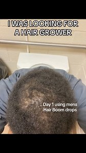 15K views · 60 reactions | Hair boom drops can regrow mens hair | Amazing Hair Care | Facebook
