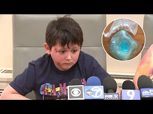 Burn victim urges kids to not follow 'Needoh Cube microwave trend' on TikTok