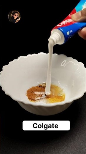 Tooth Pain Gone in 1 Day 😱 Yellow Teeth Whitening + Cavity Remedy at Home