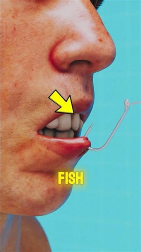 Don’t Pull a Fish Hook 🎣🚫😳#shorts #survivalskills #didyouknow