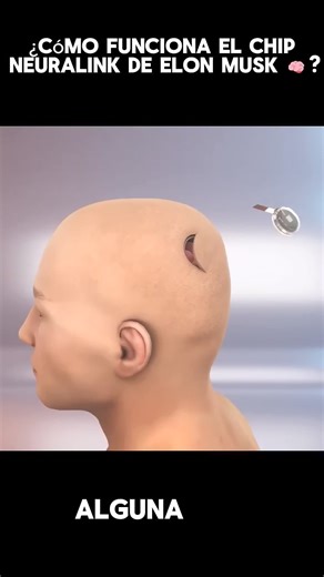 6M views · 10K reactions | El chip neoralin  | BR Collectión | Facebook