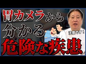 胃カメラでわかる5つの症状！鼻から検査！知っておくべき早期診断の大切さ！