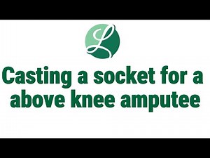 How an Above-Knee Amputee is Casted for a Prosthetic Socket | Step-by-Step Process