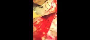 Young Guy Films Himself Bleeding To Death After Slashing Up His Arm *GRAPHIC*