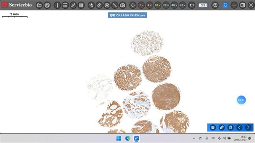 赛维尔自主研发的扫描软件saiviwer，准对SVS格式文件的扫描浏览