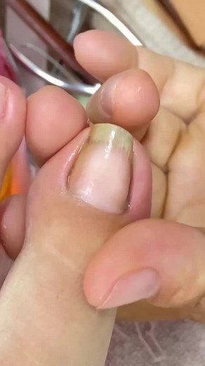 Ultimate Nail Cleaning: Satisfying Techniques Revealed