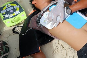 Shockable vs. Non Shockable Heart Rhythms - Avive AED