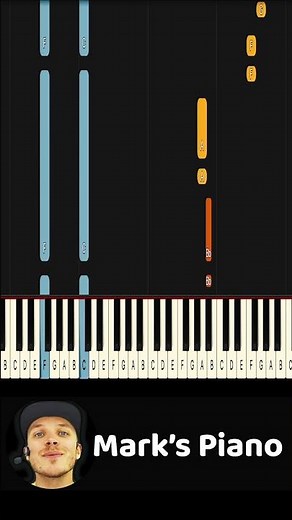 Queen - Radio Ga Ga #radiogaga