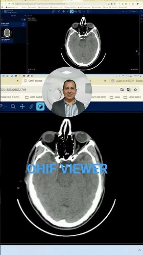 Viewer Dicom Web OHIF Open Healt Imaging Foundation @https://docs.ohif.org/deployment/