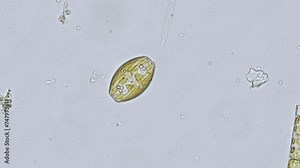 freshwater diatom algae under the microscope - optical microscope x400 magnification