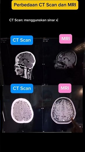 CT scan dan MRI kepala/otak adalah dua jenis pemeriksaan medis