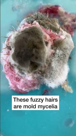 Mold under the microscope