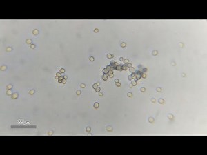 Baker's yeast under microscope