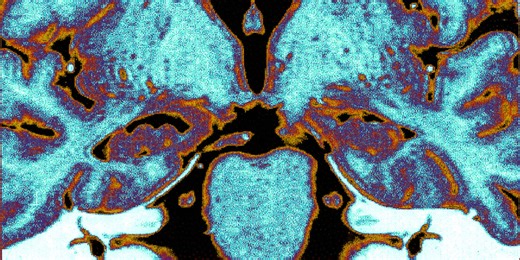 Scientists Successfully Unfroze Part of a Mouse Brain—and It Still Worked