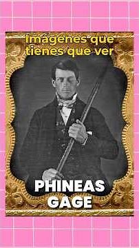 The Phineas Gage accident and the brain - Images you have to see at least once in your life