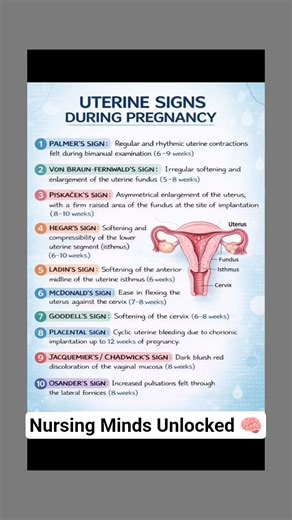 Uterine Signs During Pregnancy #nursingstudent #bscnursing #obstetrics #nursing #medical #pregnancy