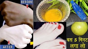 67K views · 1.4K reactions | निम्बू में ये चीज मिलाकर 5 मिनट लगालो,...
