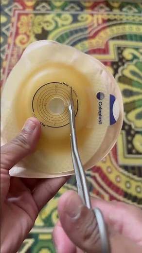How to Cut a Stoma Bag Properly? | Ileostomy Bag Cutting Guide | Stoma Care Tips | #shorts | #ostomy