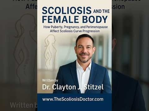 Growth Spurts, and Curve Progression in Adolescent Idiopathic Scoliosis in Females