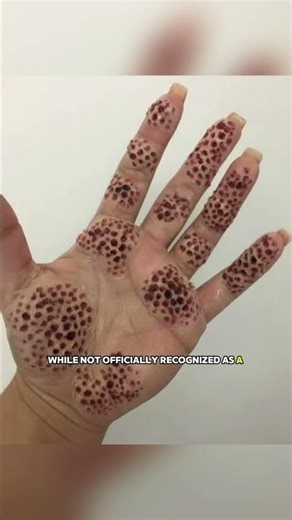 Can You Watch Till the End? (Trypophobia Edition)