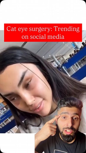 Cat eye surgery, also known as canthoplasty, is a cosmetic procedure that reshapes the outer eye corners for a lifted, almond-shaped appearance, giving a more exotic, youthful look. . . #eyedoctor #yourretinadoctor #retinaspecialist #eyehealth #eyehealthtips #eyedoc #mythbusters #mythbusters #patientcare #cateye #cateyes Do you wish to get this done? | Dr.Ashish Markan